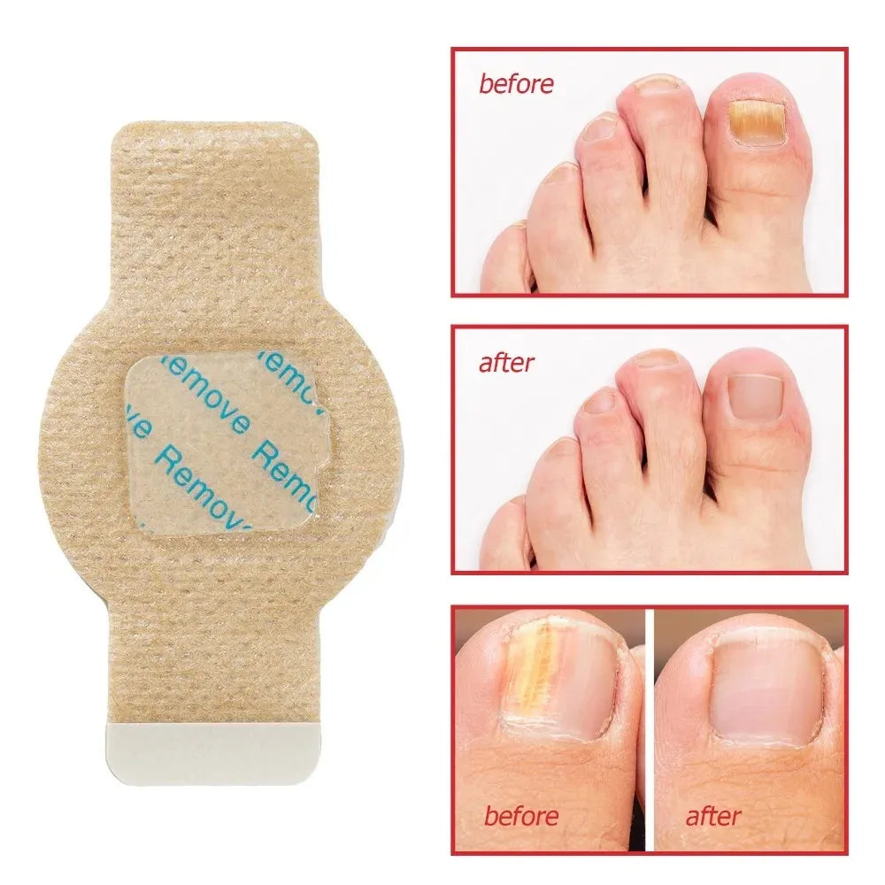 Waterproof Nail Care Patches